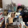 Warga Yahukimo Diduga Dianiaya Simpatisan KKB dengan Kapak, Leher Robek dan Tulang Rusuk Patah