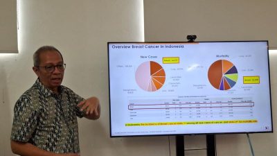 Pakar Ungkap Metode CERDIK untuk Menyembuhkan Kanker Payudara 100 Persen
