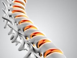 Tulang Rapuh Tak Terjadi Secara Tiba-Tiba, Kenali Gejala Osteoporosis Sejak Dini