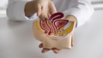 5 Pola Makan dan Gaya Hidup yang Picu Wasir atau Ambeien Menurut Dokter